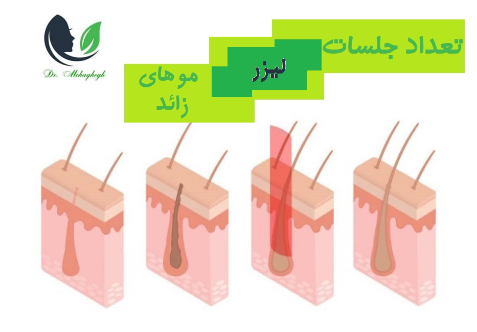 تعداد جلسات