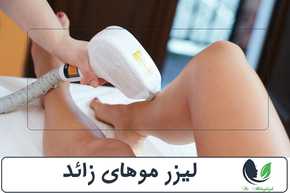 عوارض لیزر