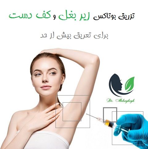 برای تعریق بیش از حد