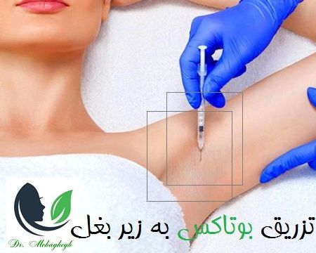 تزریق بوتاکس به زیر بغل