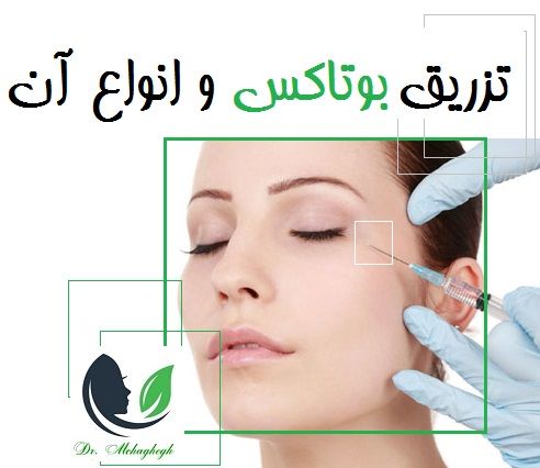 تزریق بوتاکس و انواع آن
