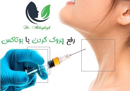 رفع چروک گردن با بوتاکس