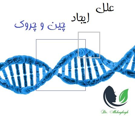 علل ایجاد چین و چروک