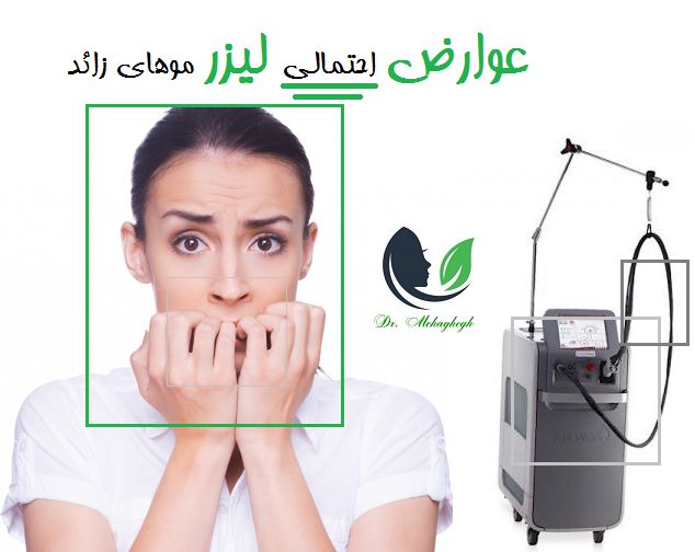 عوارض احتمالی لیزر موهای زائد