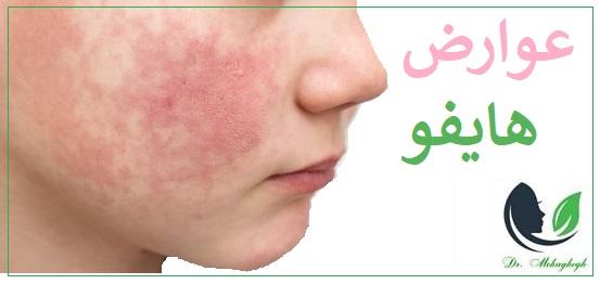 عوارض هایفوتراپی