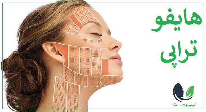 هایفوتراپی در صادقیه