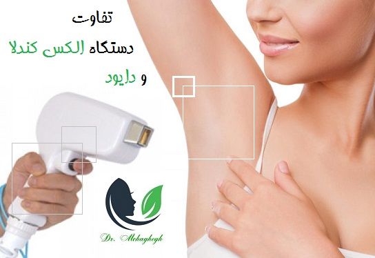 تفاوت دستگاه الکس کندلا و دایود
