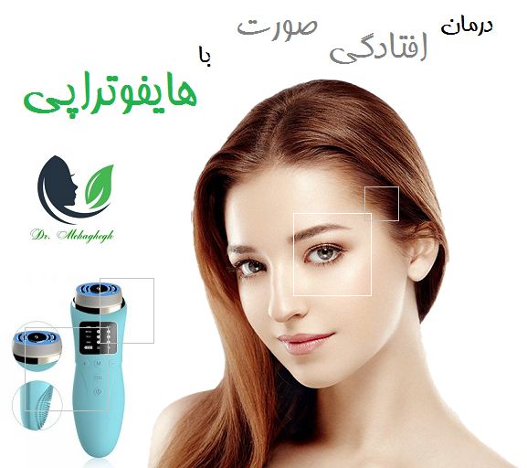 درمان افتادگی صورت با هایفوتراپی