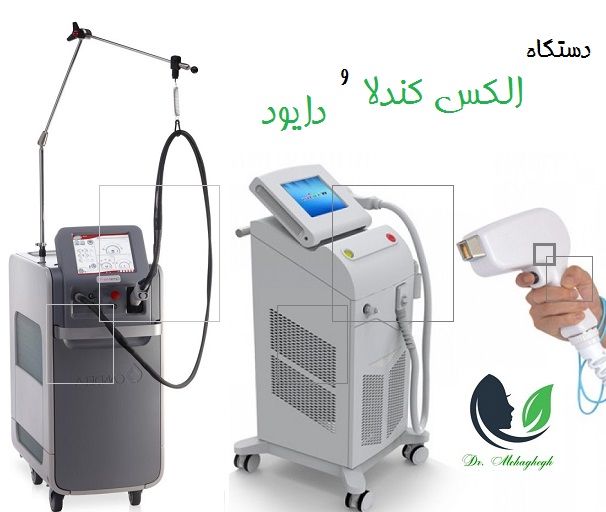 دستگاه الکس کندلا و دایود