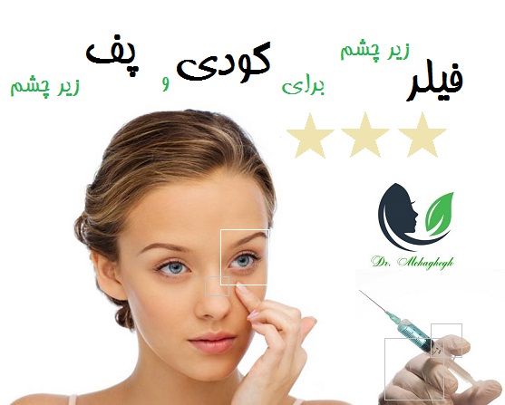 فیلر زیر چشم برای گودی و پف زیر چشم