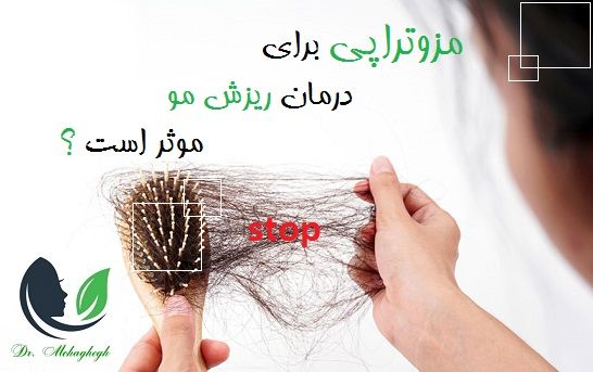 مزوتراپی برای درمان ریزش مو موثر است ؟