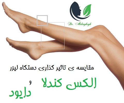 مقایسه ی تاثیر گذاری دستگاه لیزر الکس کندلا و دایود