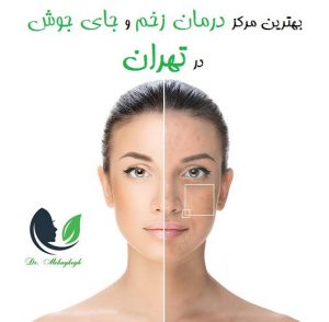 بهترین مرکز درمان زخم و جای جوش تهران