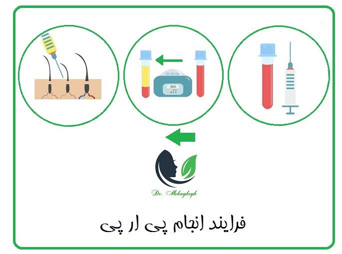 فرایند انجام پی ار پی