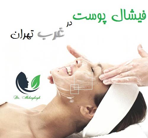 فیشال پوست در غرب تهران