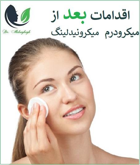 مراقبت‌ های بعد از جلسات درمانی