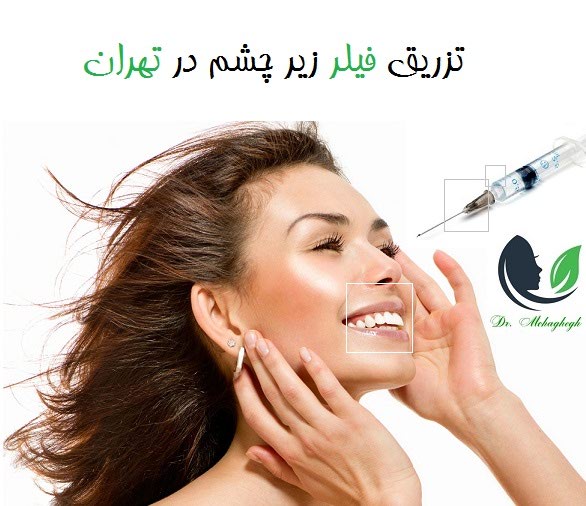 تزریق فیلر زیر چشم در تهران