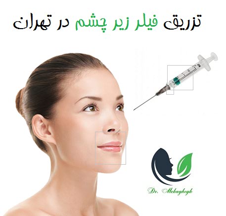 تزریق فیلر زیر چشم در تهران