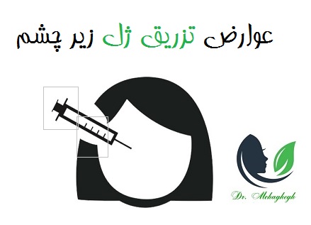 عوارض تزریق ژل زیر چشم