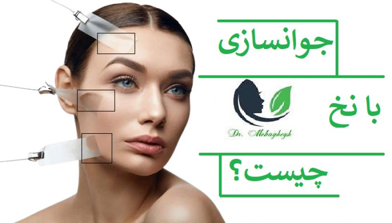 جوانسازی صورت با نخ چیست؟