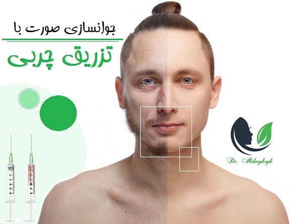 جوانسازی صورت با تزریق چربی