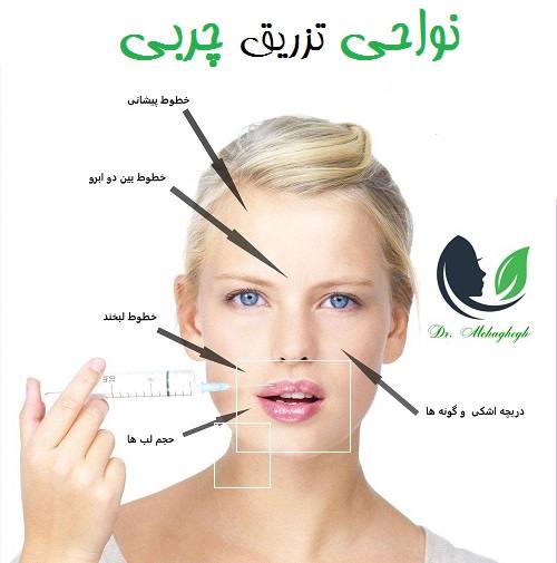 نواحی تزریق چربی صورت