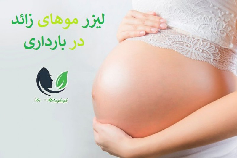 لیزر موهای زائد در بارداری