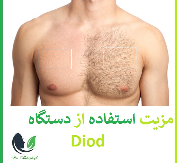 مزیت استفاده از دستگاه Diod