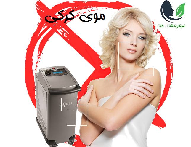 موی کرکی
