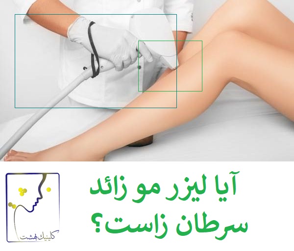 ایا لیزر مو سرطان زاست؟