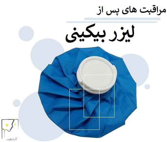 مراقبتزهای بعد از لیزر بیکینی