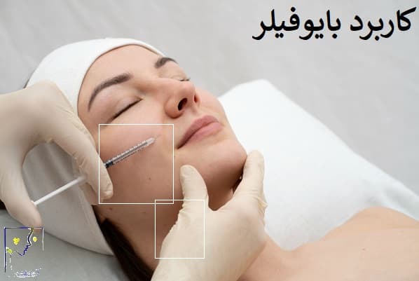 کاربرد بایوفیلر