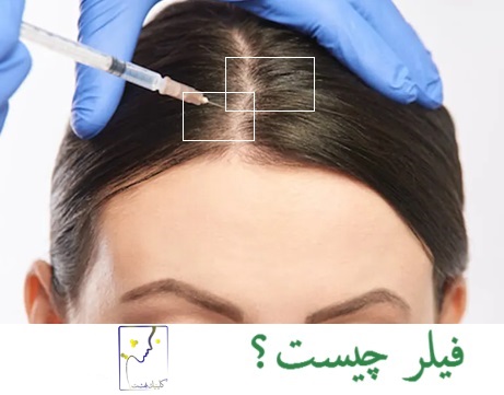 فیلر چیست؟
