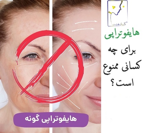 چه کسانی نباید هایفو انجام دهند؟