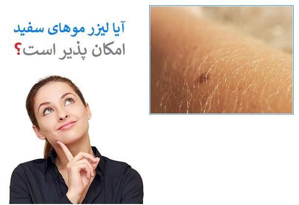 آیا لیزر موهای سفید امکان پذیر است