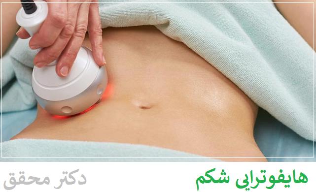 دکتر محقق هایفوتراپی شکم