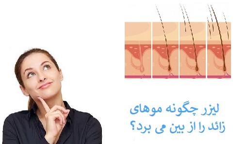 آیا لیزر موهای سفید امکان پذیر است؟