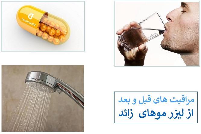 مراقبت های قبل و بعد از لیزر موهای زائد