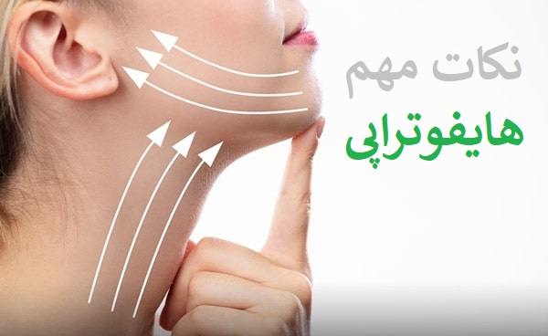 نکات مهم برای انجام هایفوتراپی غبغب