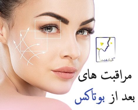 مراقبت های بعد از بوتاکس
