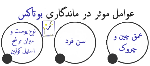 ماندگاری بوتاکس