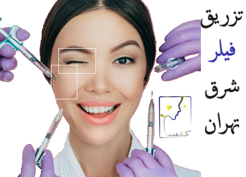 تزریق فیلر شرق تهران