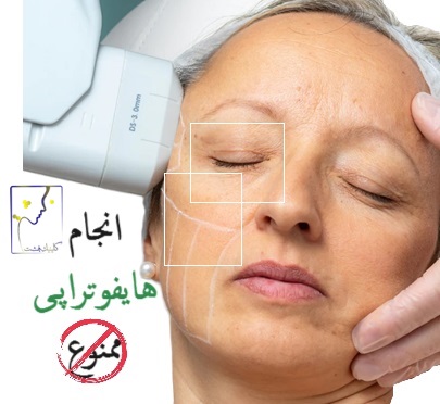 انجام هایفوتراپی ممنوع است.