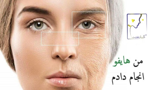 من هایفو انجام داده ام