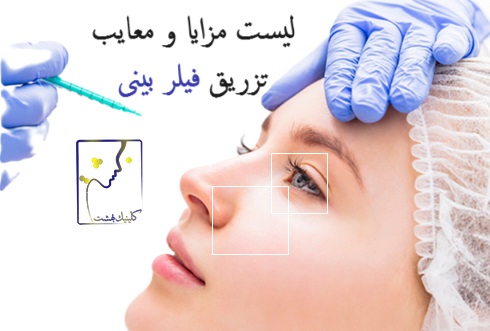 مزایا و معایب تزریق فیلر بینی