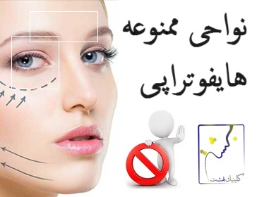 نواحی ممنوعه هایفوتراپی