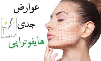 عوارض جدی هایفوتراپی