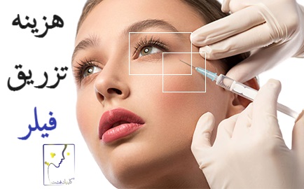 هزینه تزریق فیلر