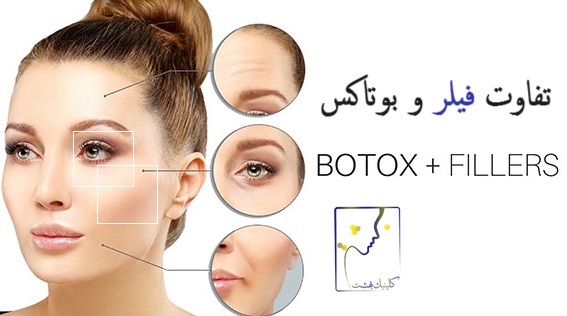 تفاوت فیلر و بوتاکس
