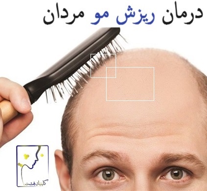 درمان ریزش مو مردان